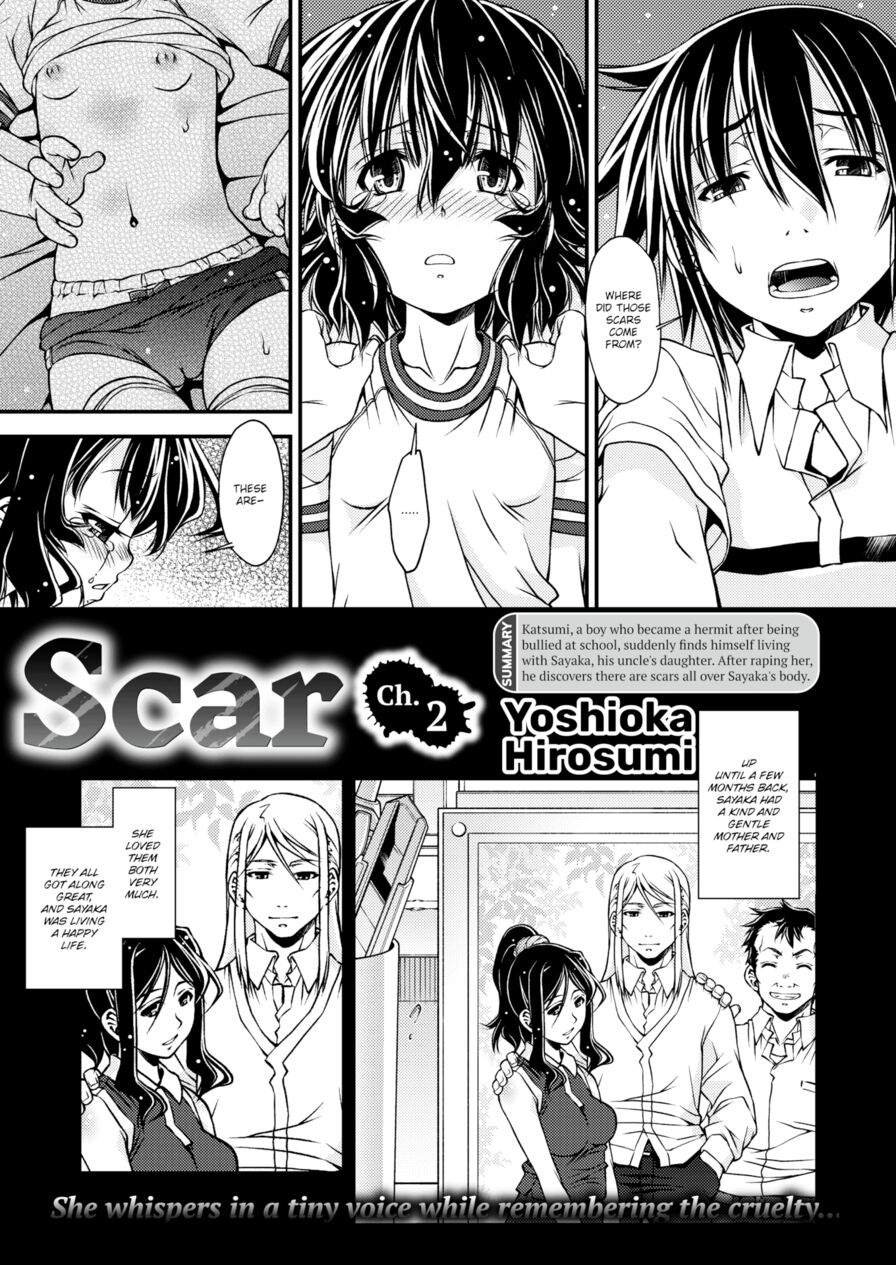 [Yoshioka Hirosumi] Scar Ch.2 (Comic X-Eros #52)